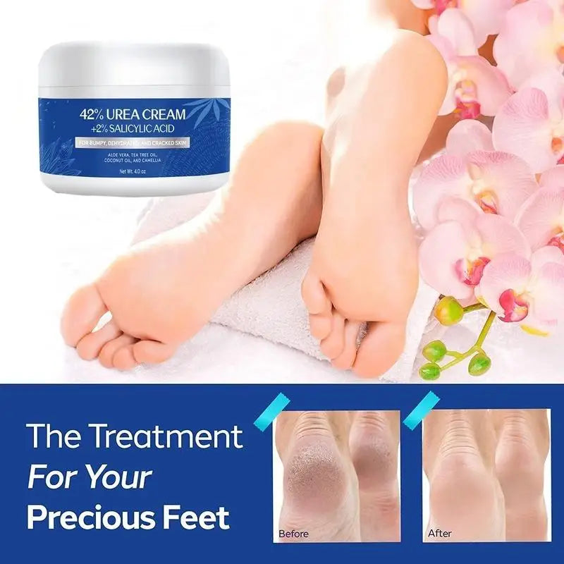 Urea Cream 42% Plus Salicylic Acid 4 Oz, Remover Dry Cracked Feet Hands