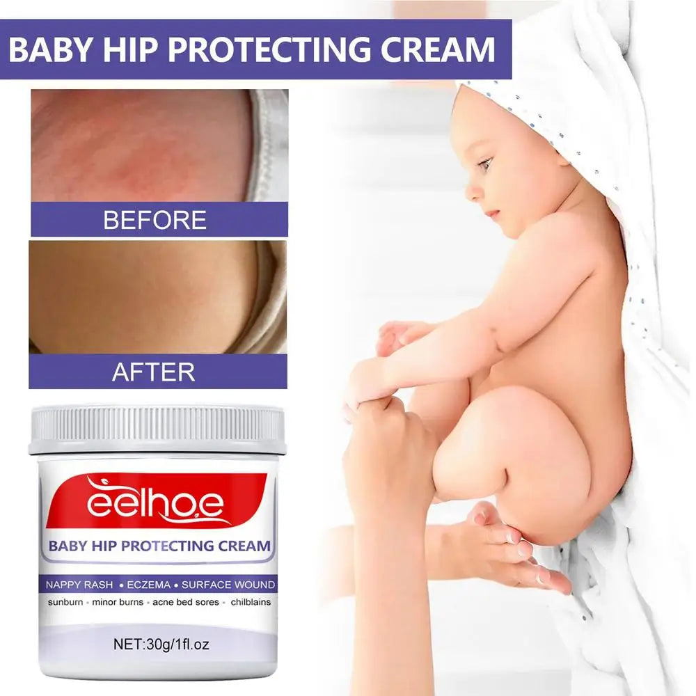 Organic Lotion Baby Hip Healing Cream Baby Diaper Ointment