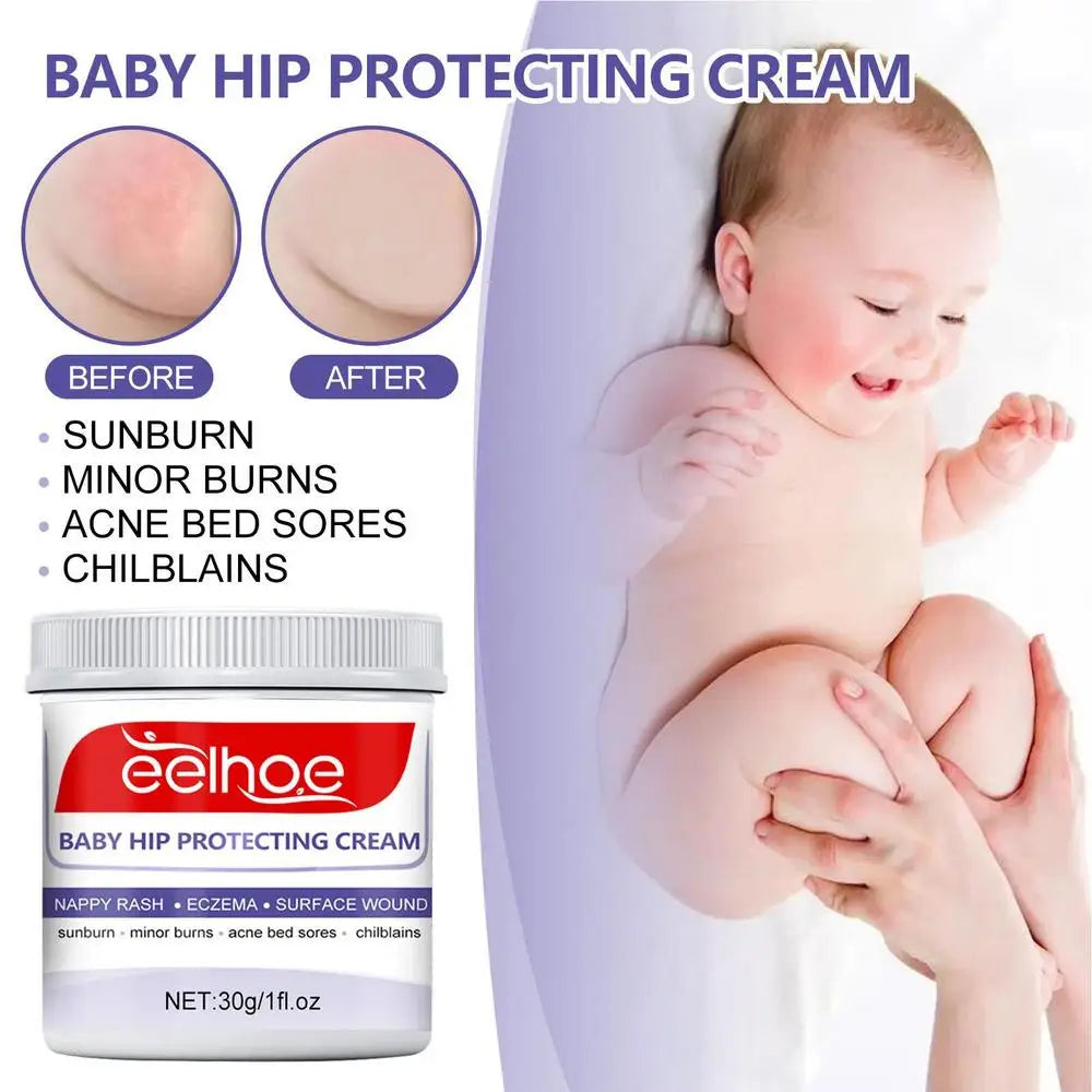 Organic Lotion Baby Hip Healing Cream Baby Diaper Ointment