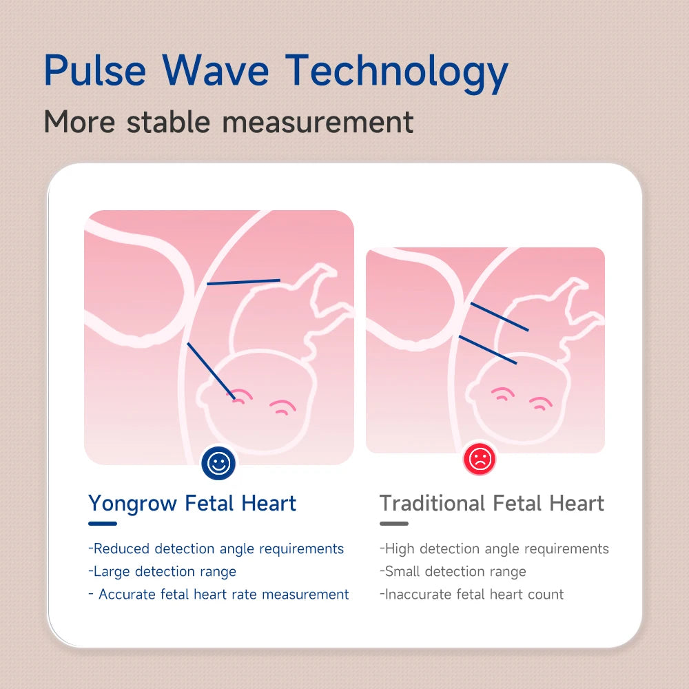 Yongrow Fetal Doppler Baby Monitor LCD Display Portable Baby Heart Rate Monitor With Earphone YK-90C For Pregnant Women