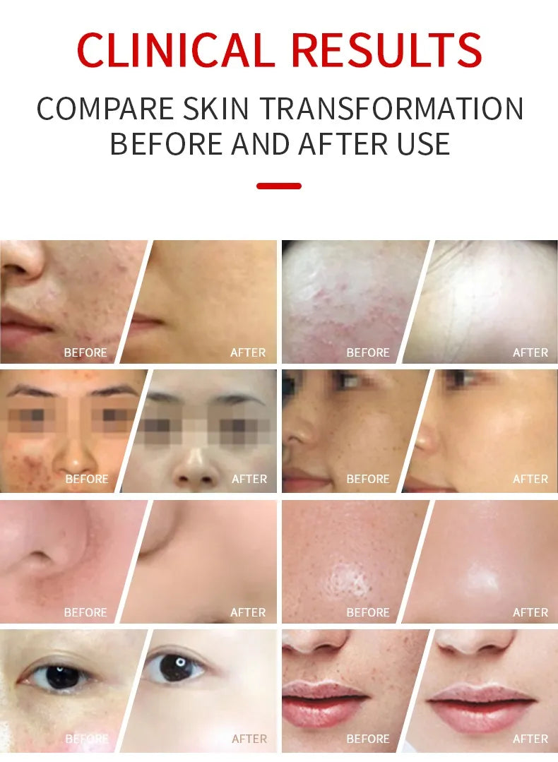 New LED Face Mask Equipment 7 In 1 Color Face SPA
