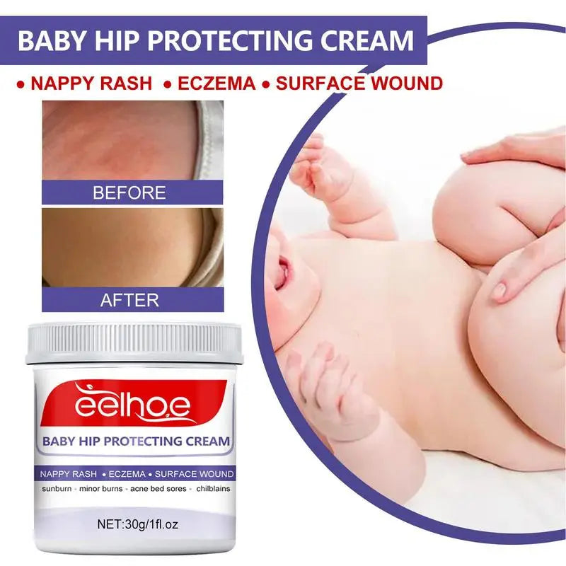 Baby Hip Protecting Cream Baby Diaper Rash Healing Cream Organic Lotion Massage Cream Multipurpose Ointment Cream for babies
