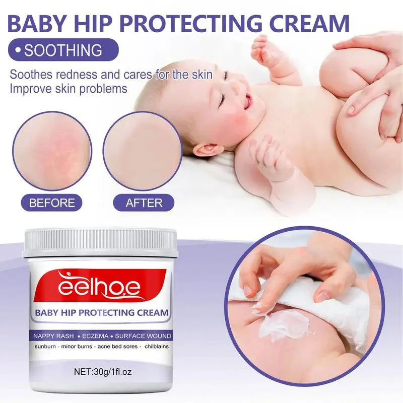 Baby Hip Protecting Cream Baby Diaper Rash Healing Cream Organic Lotion Massage Cream Multipurpose Ointment Cream for babies