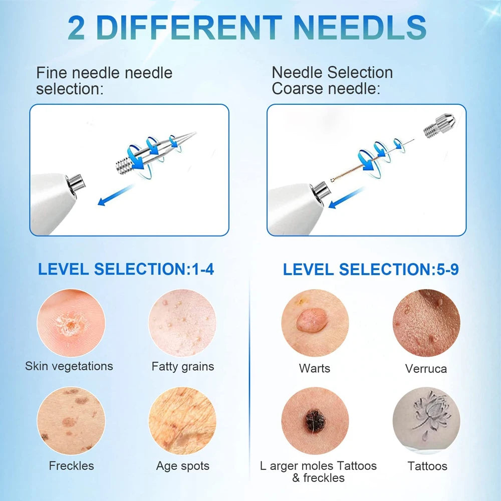 Upgrade Mole Remover Pen Portable Skin Tag Remover Pen with 9 Strength Levels for Face Body Wart Freckle Nevus Spot Treatment