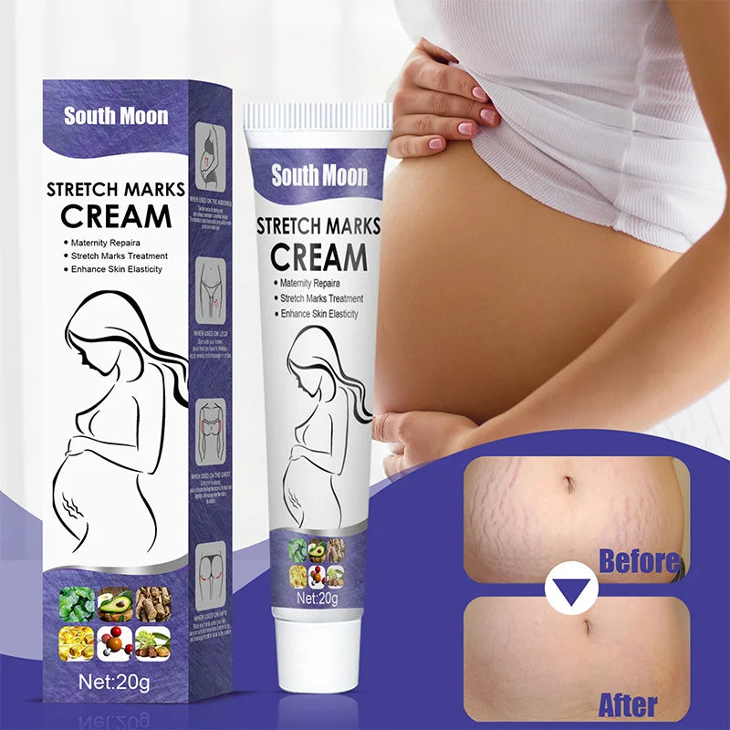 Stretch Mark Repair Cream Postpartum Pregnancy Mark Mommy Cream