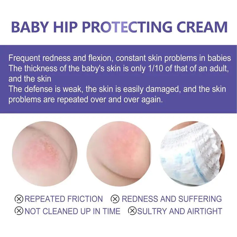 Baby Hip Protecting Cream Baby Diaper Rash Healing Cream Organic Lotion Massage Cream Multipurpose Ointment Cream for babies
