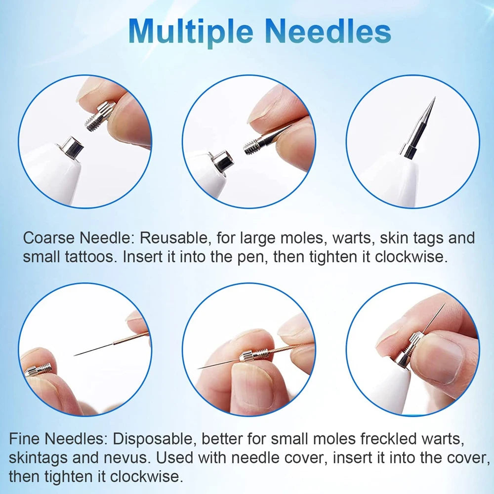 Upgrade Mole Remover Pen Portable Skin Tag Remover Pen with 9 Strength Levels for Face Body Wart Freckle Nevus Spot Treatment