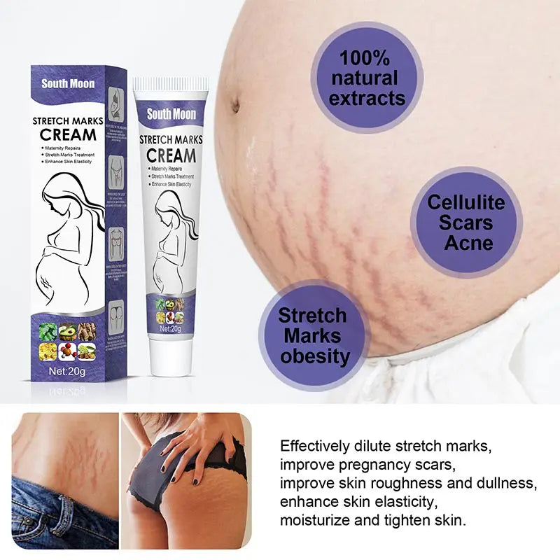 Stretch Mark Repair Cream Postpartum Pregnancy Mark Mommy Cream