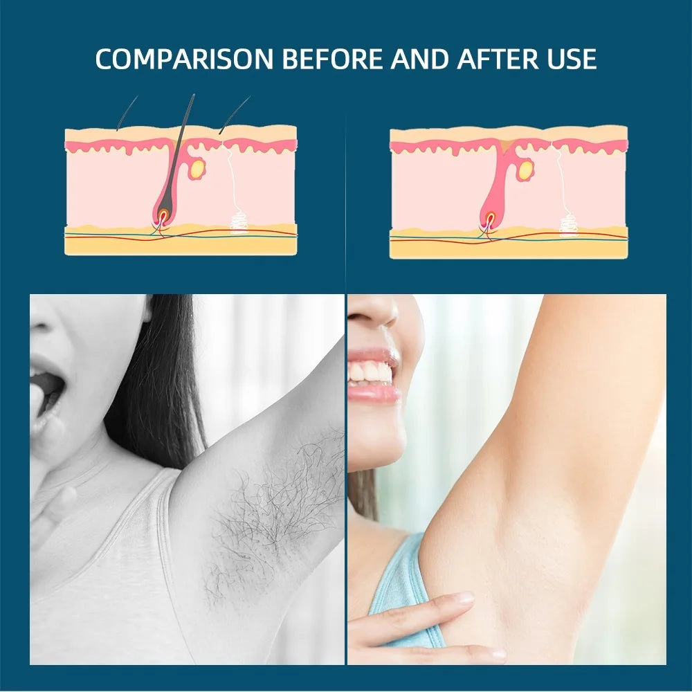 Roll On Waxing Depilatory Heater Melting Wax