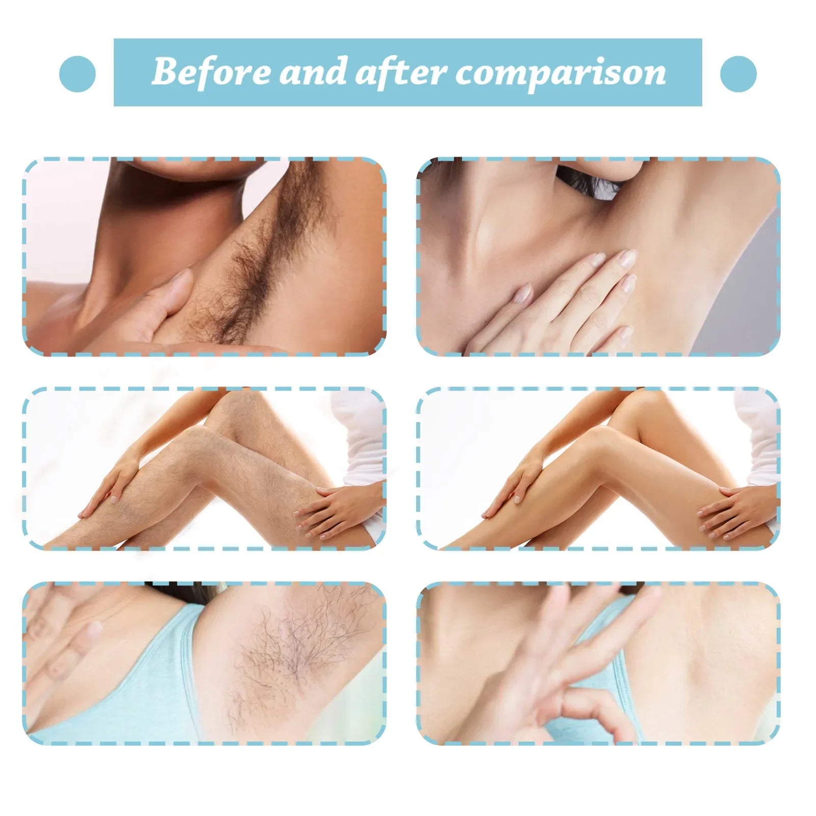 Quick Hair Removal Spray Armpit Permanent for Women Gentle Body Legs Arm Hair Growth Inhibitors Healthy Painless Care Products