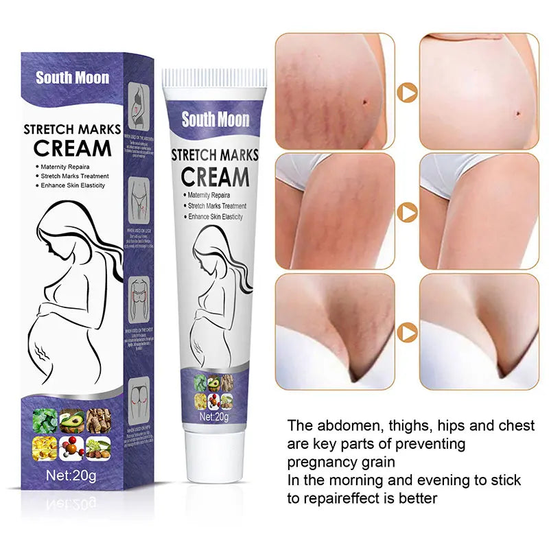 Stretch Mark Repair Cream Postpartum Pregnancy Mark Mommy Cream
